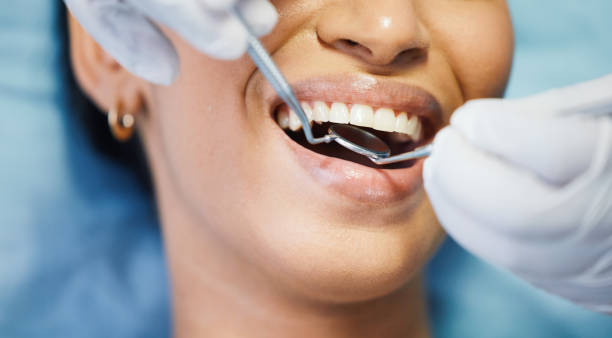 Best Tooth Infection Emergency Dentist  in Brilliant, AL