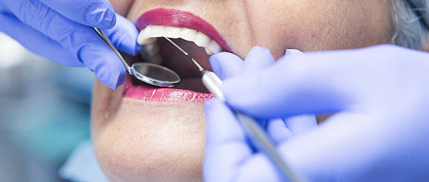 Best Knocked-Out Tooth Emergency  in Brilliant, AL